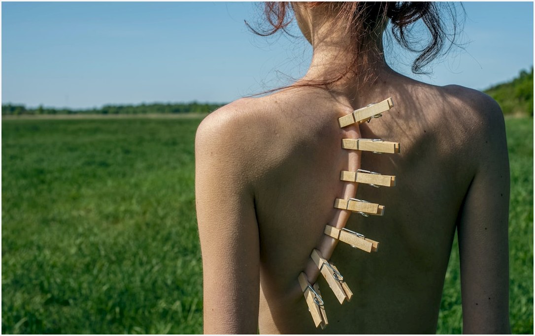 Clothespins attached to a bare back in a field.