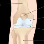 Pilates para lesão de menisco: o que adaptar e quando buscar avaliação